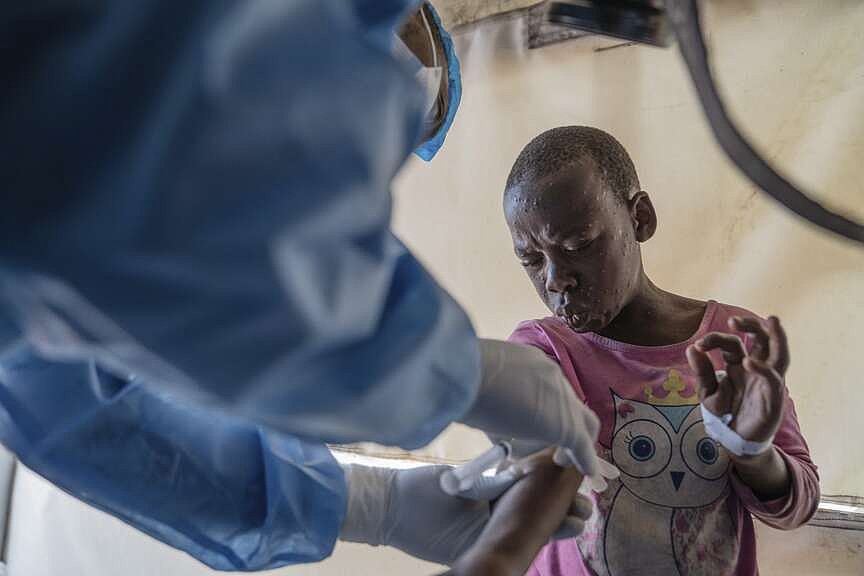 Mpox deaths rise by 107 in a week as Africa CDC calls the toll ...